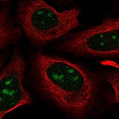 Immunocytochemistry/ Immunofluorescence: Nova1 Antibody [NBP1-86517]
