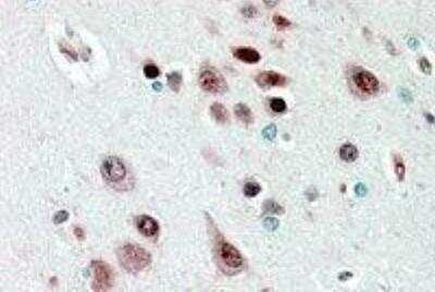 Immunohistochemistry-Paraffin: Nova1 Antibody [NBP1-00221]