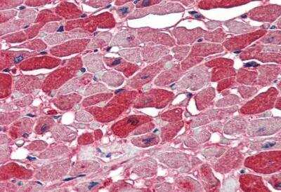 Immunohistochemistry-Paraffin: Nova1 Antibody [NBP1-00221]
