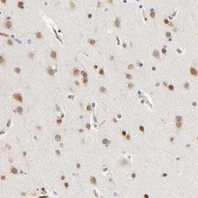 Immunohistochemistry-Paraffin: Nova1 Antibody [NBP1-86517]