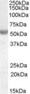 Western Blot: Nova1 Antibody [NBP1-00221]