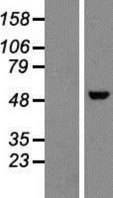 Western Blot: Nova1 Overexpression Lysate [NBP2-09833]