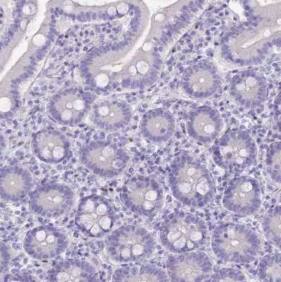 Immunohistochemistry-Paraffin: Nova2 Antibody [NBP1-92196]