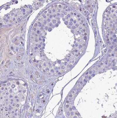 Immunohistochemistry-Paraffin: Nova2 Antibody [NBP1-92196]