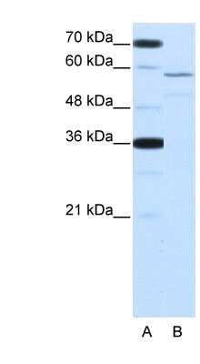 Western Blot: Nova2 Antibody [NBP1-57296]