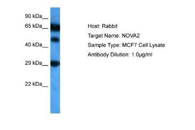 Western Blot: Nova2 Antibody [NBP2-85394]