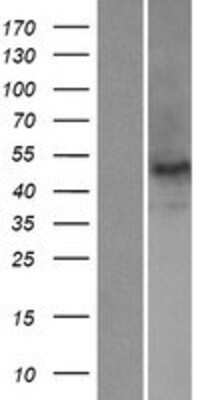 Western Blot: Nova2 Overexpression Lysate [NBP2-08107]