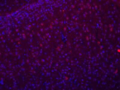 Immunocytochemistry/ Immunofluorescence: Nox4 Antibody - BSA Free [NB110-58849]