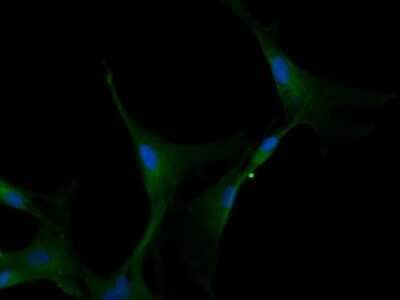 Immunocytochemistry/ Immunofluorescence: Nox4 Antibody - BSA Free [NB110-58849]