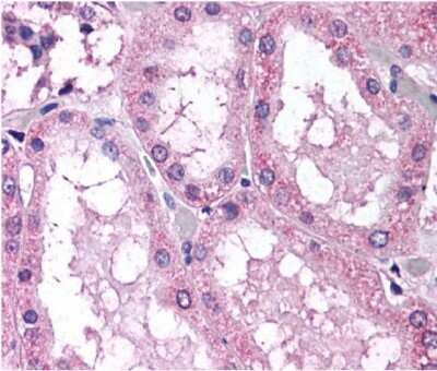 Immunohistochemistry: Nox4 Antibody - BSA Free [NB110-58849]
