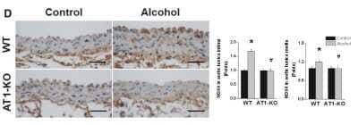 Immunohistochemistry: Nox4 Antibody - BSA Free [NB110-58849]