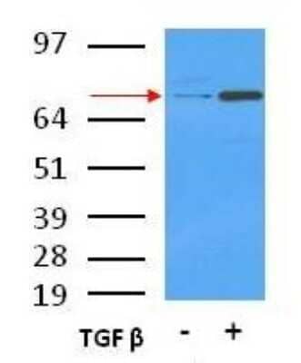 Western Blot: Nox4 AntibodyBSA Free [NB110-58849]