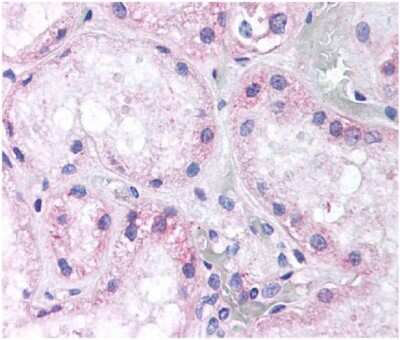 Immunohistochemistry: Nox4 Antibody - BSA Free [NB110-58851]