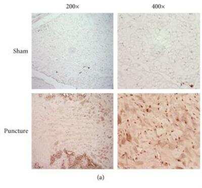 Immunohistochemistry: Nox4 Antibody - BSA Free [NB110-58851]