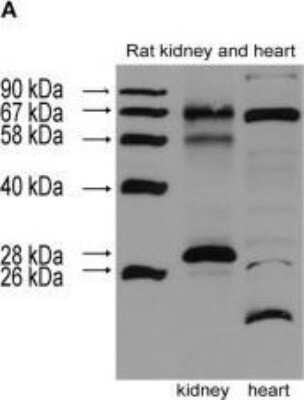 Western Blot: Nox4 AntibodyBSA Free [NB110-58851]