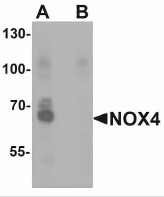 Western Blot: Nox4 AntibodyBSA Free [NBP2-41293]