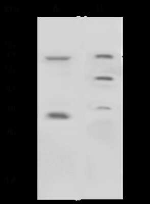 Western Blot: Nox4 Antibody [NBP2-99109]