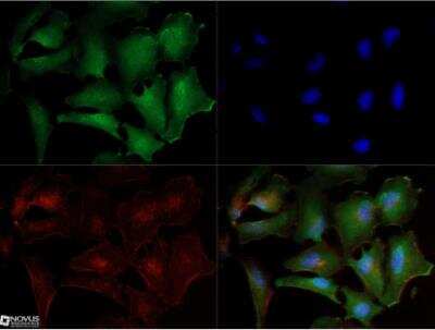 Immunocytochemistry/ Immunofluorescence: Noxa Antibody (114C307.1) - Azide Free [NBP2-33250]