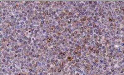 Immunohistochemistry-Paraffin: Noxa Antibody (114C307.1) - Non-Recombinant Monoclonal [NB600-1159]