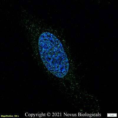 Immunocytochemistry/ Immunofluorescence: Noxa Antibody (114C307.1R) - BSA Free [NBP3-07012]