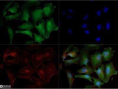 Immunocytochemistry/ Immunofluorescence: Noxa Antibody (114C307.1R) - BSA Free [NBP3-07012]