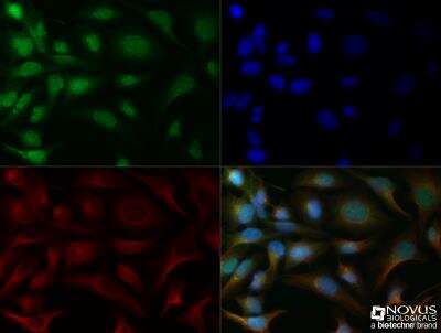 Immunocytochemistry/ Immunofluorescence: Noxa Antibody [NB100-56368]