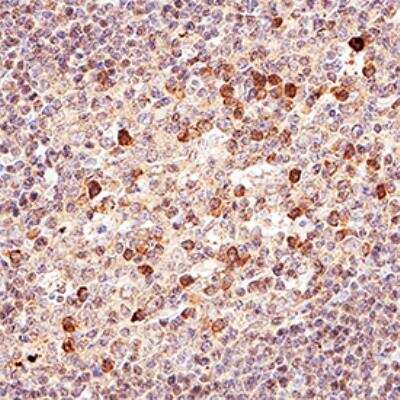 Immunohistochemistry-Paraffin: Noxa Antibody [NB100-56368]