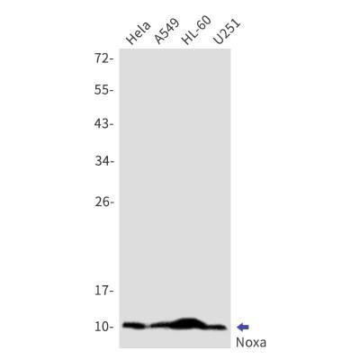 Western Blot: Noxa Antibody (S07-3H6) [NBP3-19820]