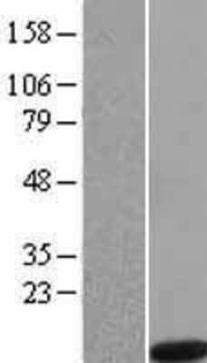 Western Blot: Noxa Overexpression Lysate [NBL1-14534]