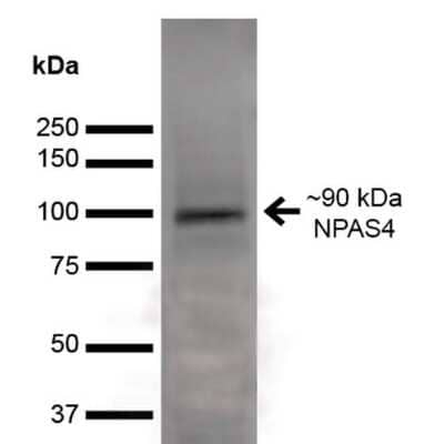 Western Blot: Npas4 Antibody (S408-79) [NBP2-59332]