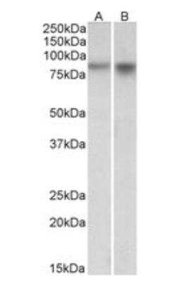 Western Blot: Npas4 Antibody [NBP1-68863]