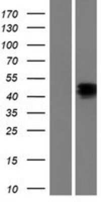 Western Blot: Neuronal Pentraxin 1 Overexpression Lysate [NBP2-08105]