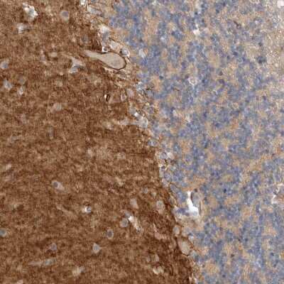 Immunohistochemistry-Paraffin: NrCAM Antibody [NBP1-88365]