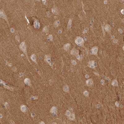 Immunohistochemistry-Paraffin: NrCAM Antibody [NBP1-88365]