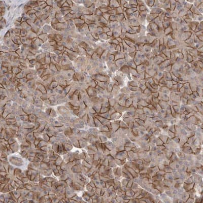 Immunohistochemistry-Paraffin: NrCAM Antibody [NBP1-88365]