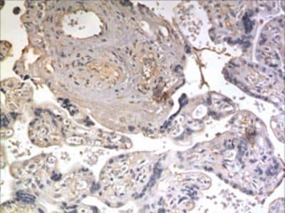 Immunohistochemistry-Paraffin: NrCAM Antibody (MM0495-8E25) - Azide and BSA Free [NBP2-11826]