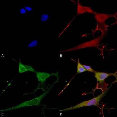 Immunocytochemistry/ Immunofluorescence: NrCAM Antibody (S364-51) [NBP2-42191]