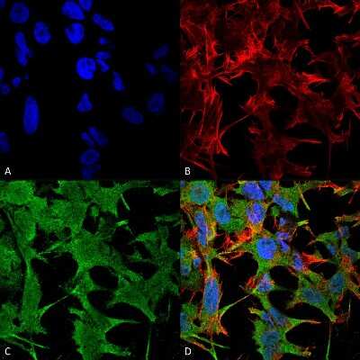 Immunocytochemistry/ Immunofluorescence: NrCAM Antibody (S364-51) [NBP2-42191]