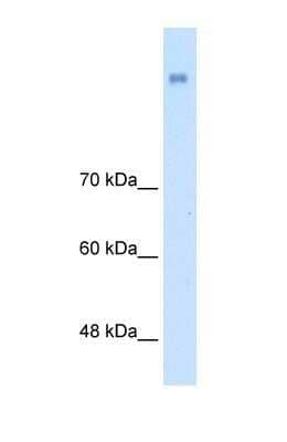 Western Blot: NrCAM Antibody [NBP1-59501]