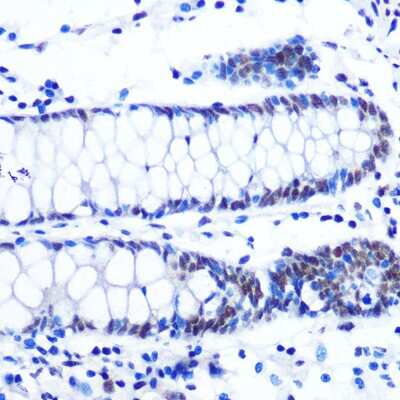 Immunohistochemistry-Paraffin: Nrf1 Antibody (4Q4E7) [NBP3-16161]