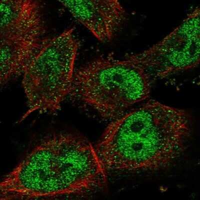 Immunocytochemistry/ Immunofluorescence: Nrf1 Antibody [NBP1-89125]