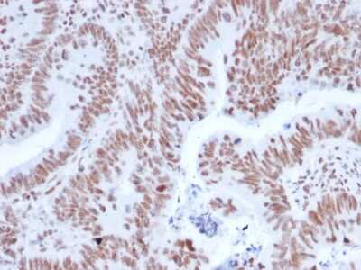 Immunohistochemistry-Paraffin: Nrf1 Antibody (NRF1/2608) [NBP3-07450]