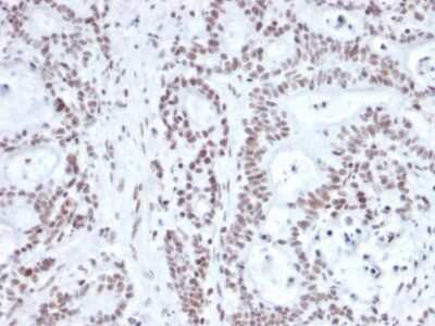 Immunohistochemistry-Paraffin: Nrf1 Antibody (NRF1/2609) - Azide and BSA Free [NBP3-08773]