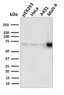 Western Blot: Nrf1 Antibody (NRF1/2609)Azide and BSA Free [NBP3-08773]