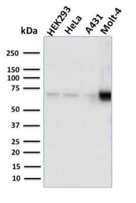 Western Blot: Nrf1 Antibody (NRF1/2609) [NBP3-07451]