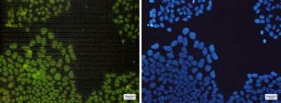 Immunocytochemistry/ Immunofluorescence: Nrf1 Antibody (S02-9A7) [NBP3-14960]