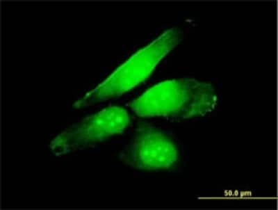 Immunocytochemistry/ Immunofluorescence: Nrf2 Antibody (1B8) [H00004780-M03]