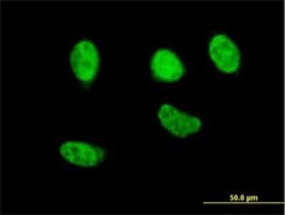 Immunocytochemistry/ Immunofluorescence: Nrf2 Antibody (2G7) [H00004780-M02]