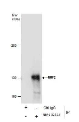 Immunoprecipitation of Nrf2 from HepG2 Whole Cell Extracts Using Nrf2 Antibody