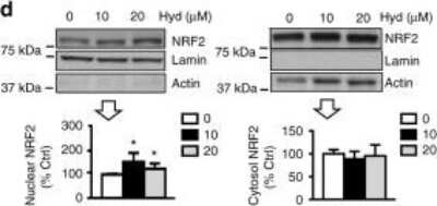 Detection of Nrf2 in Treated SH-SY5Y Cells by Western Blot